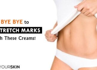 How to Get Rid of Stretch Marks Fast: Best Removal Creams for Stretch Mark 2022