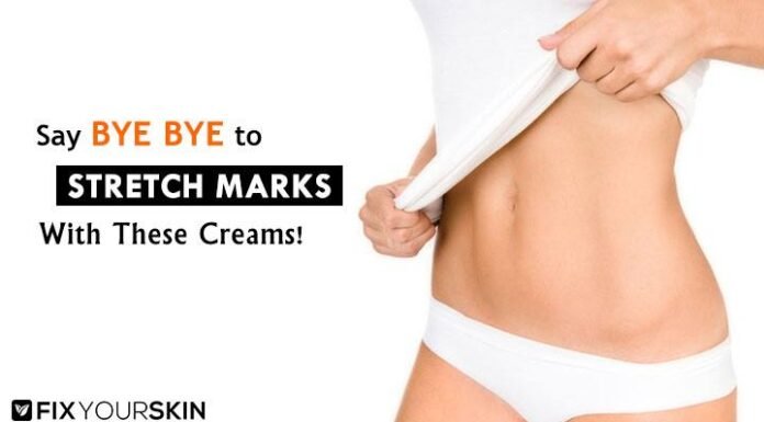 How to Get Rid of Stretch Marks Fast: Best Removal Creams for Stretch Mark 2022