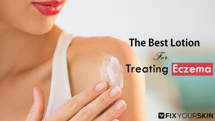 Best Lotion reviews for Eczema