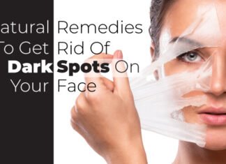 How to Get Rid of Brown Spots Naturally