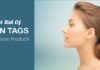 6 Best Skin Tag Removal Products