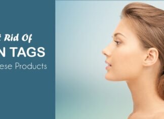 ‎6 Best Skin Tag Removal Products