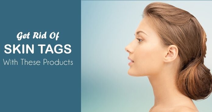 6 Best Skin Tag Removal Products