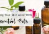 The 8 Best Essential Oils for Acne The 8 Best Essential Oils for Acne Review by Fix Your Skin