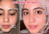 YTTP Retinal + Niacinamide Youth Serum: A Game-Changing Skincare Review FAULT Magazine Reviews: Youth To The People Retinal + Niacinamide Youth Serum.fault