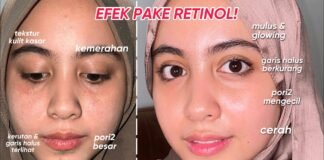 YTTP Retinal + Niacinamide Youth Serum: A Game-Changing Skincare Review FAULT Magazine Reviews: Youth To The People Retinal + Niacinamide Youth Serum.fault