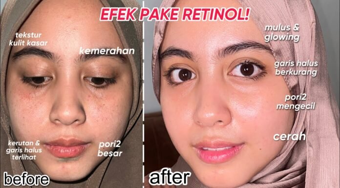 YTTP Retinal + Niacinamide Youth Serum: A Game-Changing Skincare Review FAULT Magazine Reviews: Youth To The People Retinal + Niacinamide Youth Serum.fault