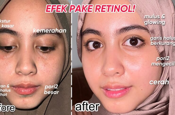 YTTP Retinal + Niacinamide Youth Serum: A Game-Changing Skincare Review FAULT Magazine Reviews: Youth To The People Retinal + Niacinamide Youth Serum.fault