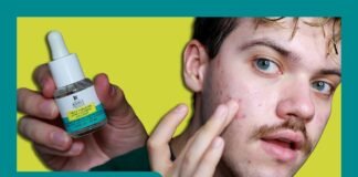 The Ultimate Review: Truly Targeted Acne-Clearing Pimple Patch with Salicylic Acid – Does It Really Work? Kiehl's Since 1851 Truly Targeted Acne