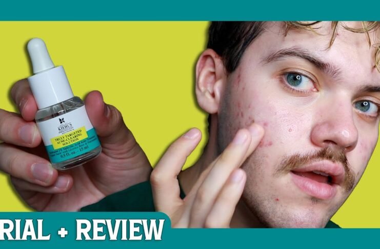 The Ultimate Review: Truly Targeted Acne-Clearing Pimple Patch with Salicylic Acid – Does It Really Work? Kiehl's Since 1851 Truly Targeted Acne